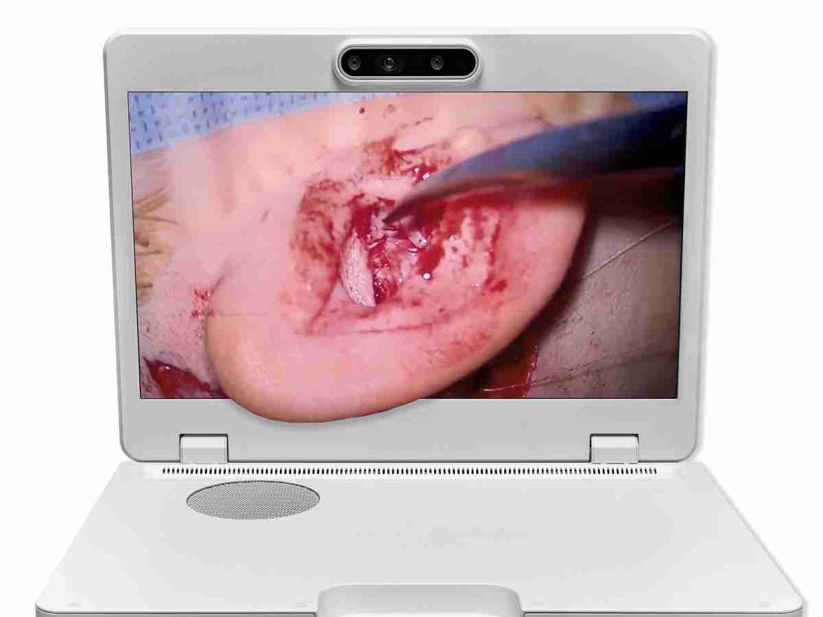 达擎之＂Heads-up 3D显微手术显示系统＂，，，，整合4K裸眼3D显示及眼球追踪系统，，，，具备快速追踪人眼移动位置功能，，减轻医师长时间维持固定姿势的负担，，让医师能有更宽广清晰的3D立体视野及更舒适的姿势来执行手术。。。